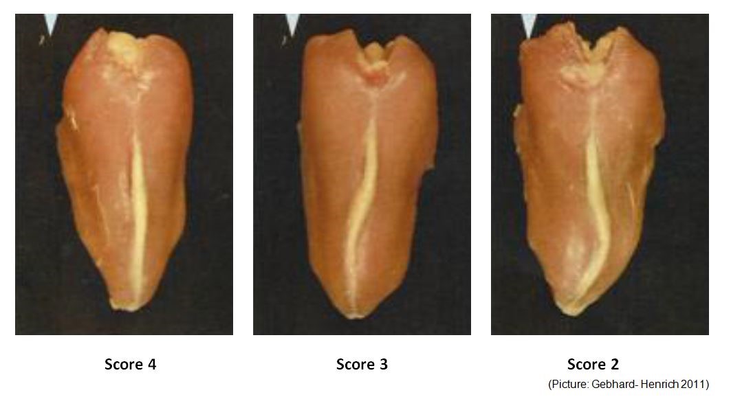 évaluation de la palpation osseuse